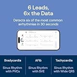 AliveCor KardiaMobile 6L Max FDA-Cleared 6-Lead Personal EKG Monitor