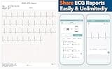 EMAY Portable ECG Monitor EMG-20 with 1.77-Inch Color Screen and PC Sync